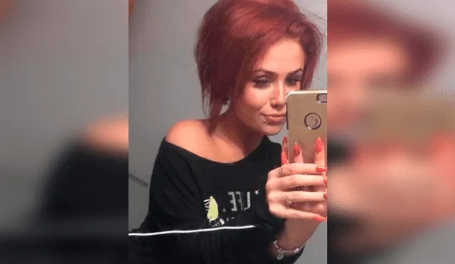 Mujer pagó 200 dólares para tener labios perfectos, pero cirujano se los dejó deformados [FOTOS]