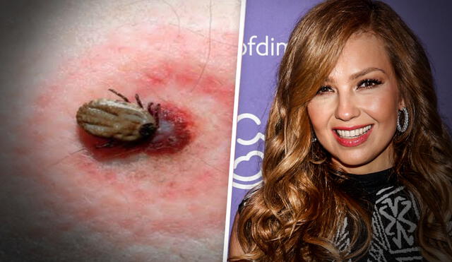 Thalia confiesa la dura batalla que enfrenta contra el Lyme