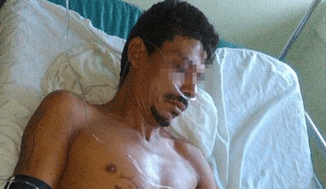 Nicaragua: Lo acusan de robo, le amputan los pies y era inocente