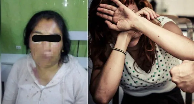Tacna: Mujer es desfigurada y golpeada por su cuñado ebrio