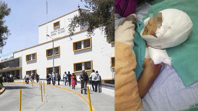 Menor se encuentra internado en el hospital Honorio Delgado