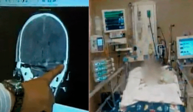 Médicos retiran bala perdida de cabeza de bebé, pero su estado aún es crítico [VIDEO]