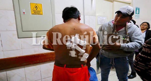 Arequipa: 21 heridos deja enfrentamiento entre obreros y policías [FOTOS y VIDEO]
