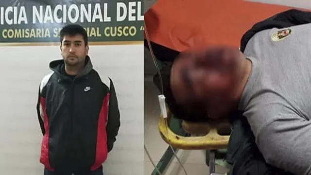 Cusco: Conductor que arrastró a policía estaba drogado [VIDEO]