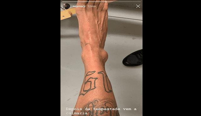 Neymar enseñó el terrible estado de su tobillo derecho por Instagram [FOTO]