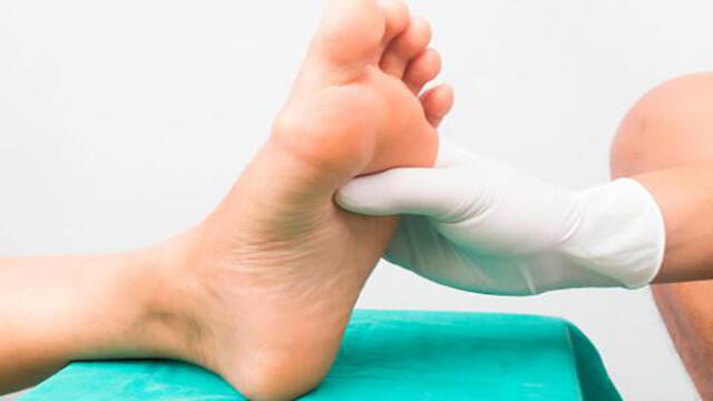 Ulceraciones y amputaciones pueden evitarse con adecuado cuidado del pie diabético 