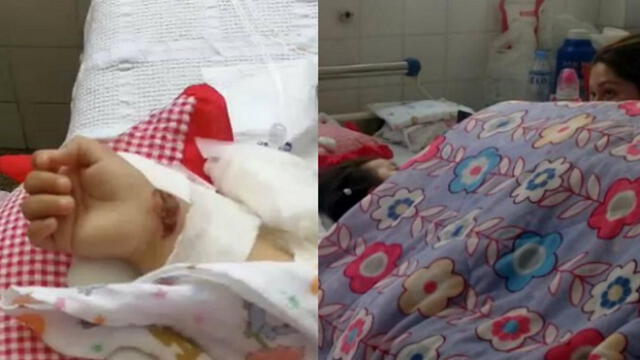 Menor de un año sufrió graves quemaduras en el cuerpo por explosión de módem de internet [VIDEO]