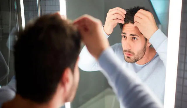 Los hombres suelen ser quienes más padecen la alopecia. Foto: difusión