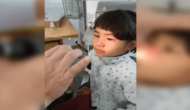 Facebook viral: médico extrae extraña criatura de las fosas nasales de una niña [VIDEO]