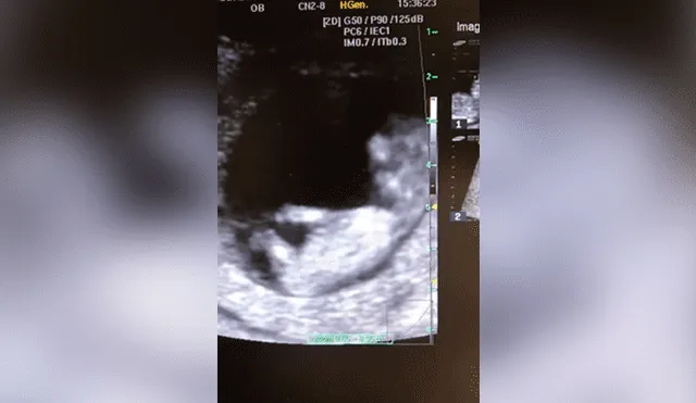 Facebook viral: bebé de 12 semanas juega a la ‘resbaladilla’ en el vientre de su madre y todo queda registrado