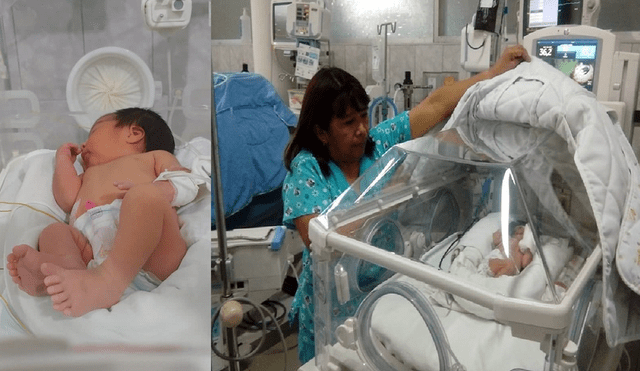 Hermosa bebé nace en hospital de Chimbote con 24 dedos
