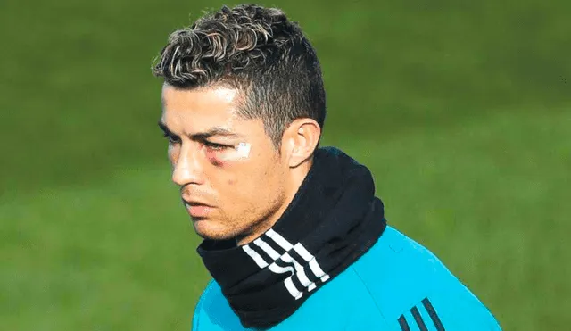 Cristiano Ronaldo presume de su "belleza" luego del corte que sufrió en el rostro