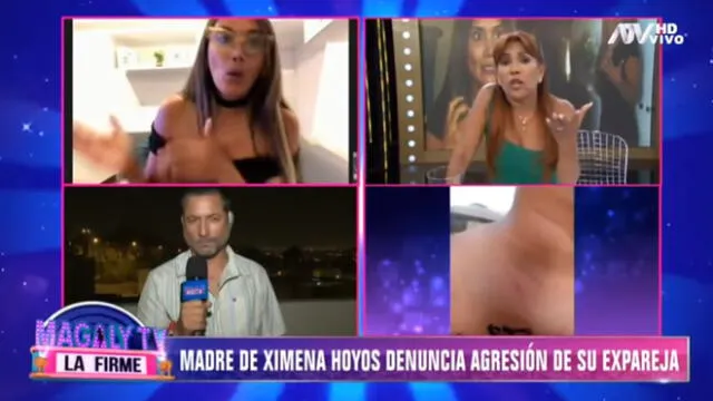 Madre de Ximena Hoyos molesta con entrevista hecha por Magaly Medina. Foto: Captura