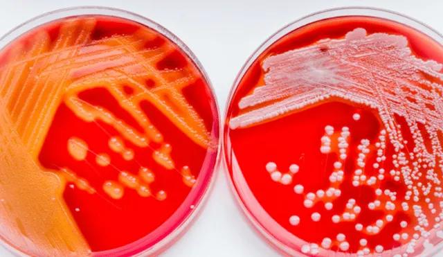 Peligrosa bacteria cobra la vida de una niña de 6 años