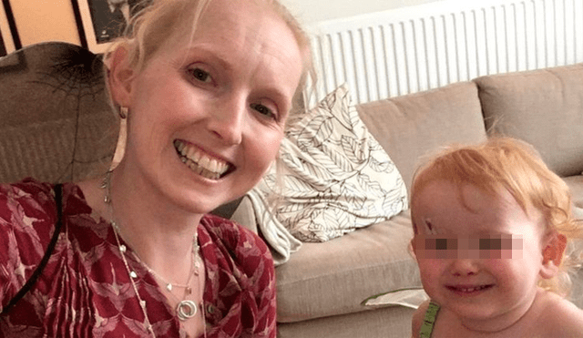 La mujer de 39 años sufre el síndrome de Sjogren. (Foto: NHS)