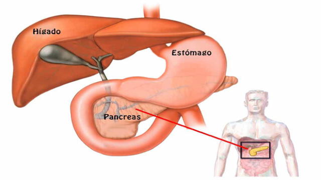 7 cosas que no conocías del cáncer de páncreas [FOTOS]