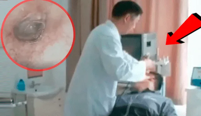 YouTube viral: médico revisa oído de joven y encuentra terrorífica criatura en su interior [VIDEO]