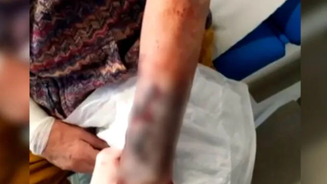Anciano es agredido brutalmente tras sufrir el robo de su reloj valorizado en 100 000 euros [VIDEO]