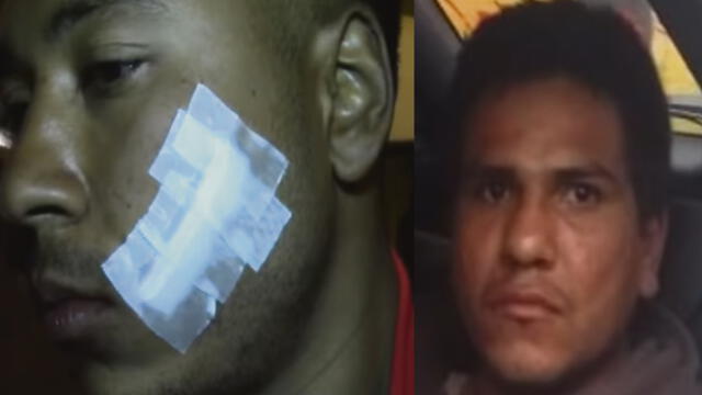 Cobrador de bus insultó y desfiguró a extranjero en posible ataque xenófobo[VIDEO]