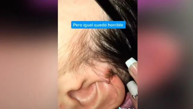 Desliza las imágenes para ver lo que pasó con esta joven y el piercing que se hizo en la oreja. Foto: Luna Fernández/TikTok