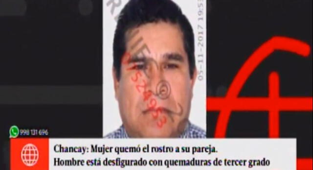 Huaral: denuncian a mujer que habría quemado el rostro de su conviviente [VIDEO]