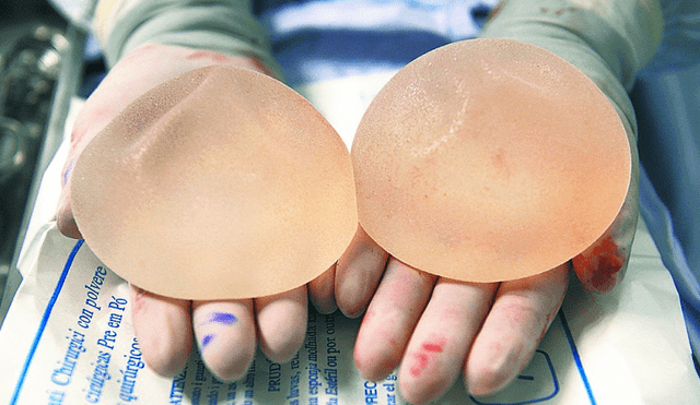 En EE.UU. preocupante estudio revela relación de cáncer de mama con implantes mamarios