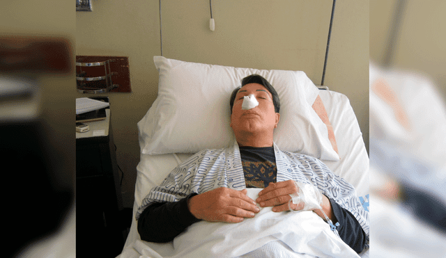 Jimmy Santi reaparece en redes tras someterse a delicada cirugía [VIDEO]