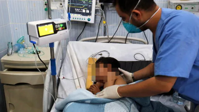 Niño de 4 años quedó en coma después de tragar un globo por accidente