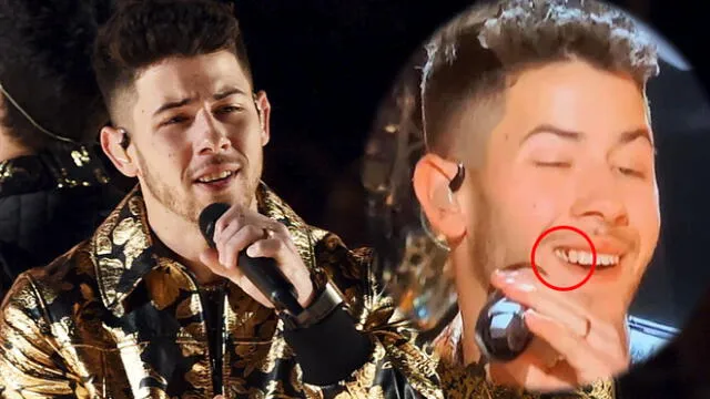 Nick Jonas recibe críticas por cantar con los dientes sucios