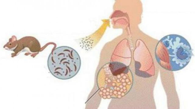 El síndrome pulmonar del hantavirus se parece a una influenza. Foto: Infogate.