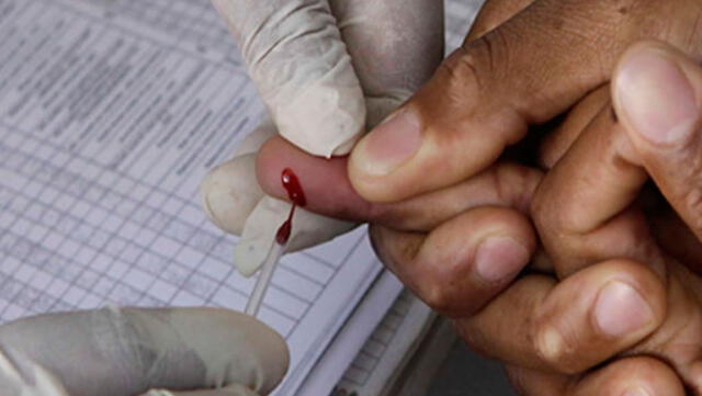 Minsa: En el Perú unas 16.250 personas tienen VIH y no lo saben  