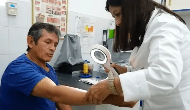Detectan probables casos de cáncer a la piel en Piura.