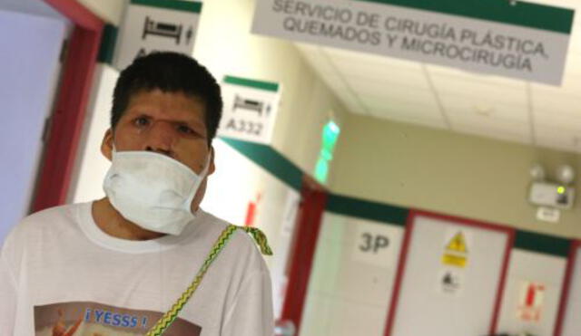 Reconstruyen rostro de paciente con tumor en Hospital de Emergencia de Villa El Salvador