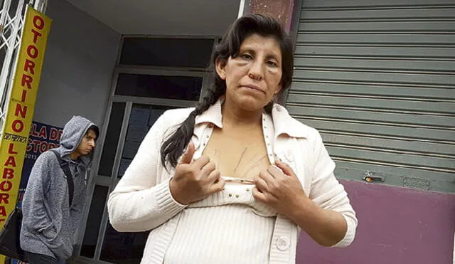 Cusco: Subprefecta de Acos es denunciada por golpear a mujer
