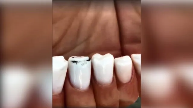 Facebook: Las uñas con forma de dientes que revolucionan la red [VIDEO]