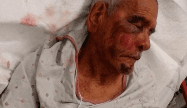 EE.UU.: Anciano de 92 años recibe brutal golpiza por ser mexicano