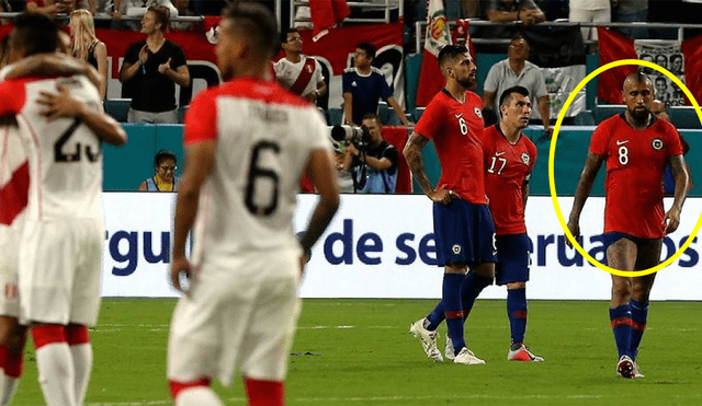 Arturo Vidal recibió un botellazo en la cabeza tras el Perú vs Chile