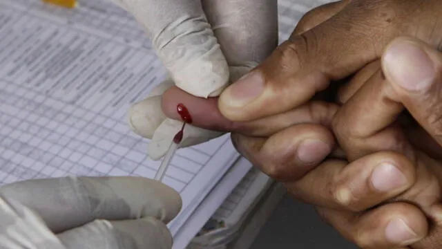 Cerca de 16,250 personas viven con VIH sin saberlo