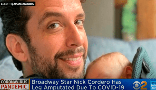 Nick Cordero, actor de Brodway, sufre la amputación de una pierna por el coronavirus