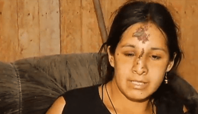 Mujer quedó desfigurada tras salvaje agresión de su expareja [VIDEO]
