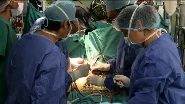 SIS: 130 trasplantes de órganos fueron realizados en los  dos últimos años