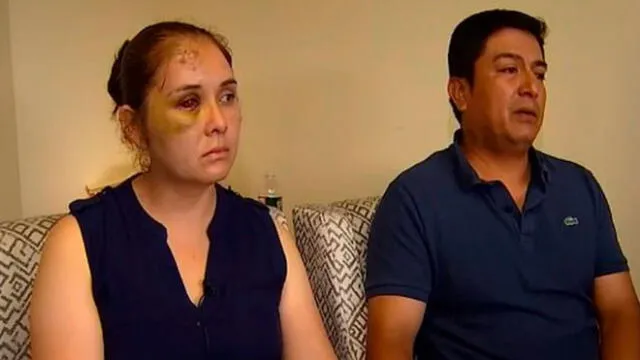 Madre recibió brutal golpiza tras denunciar los ataques racistas que recibía hijo en el colegio. Foto: NBC New York.
