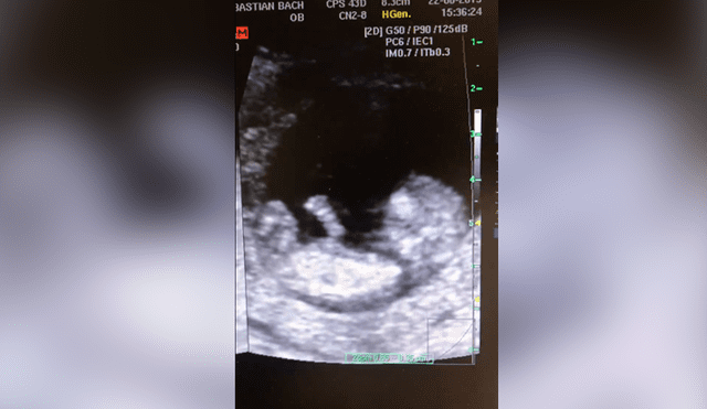Facebook viral: bebé de 12 semanas juega a la ‘resbaladilla’ en el vientre de su madre y todo queda registrado