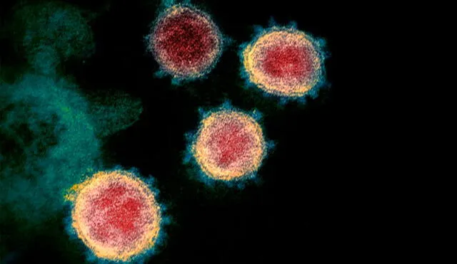 Imagen microscópica del coronavirus causante del COVID-19 en un paciente de EE. UU. Crédito: NIAID RML.