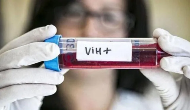 VIH. Foto: difusión