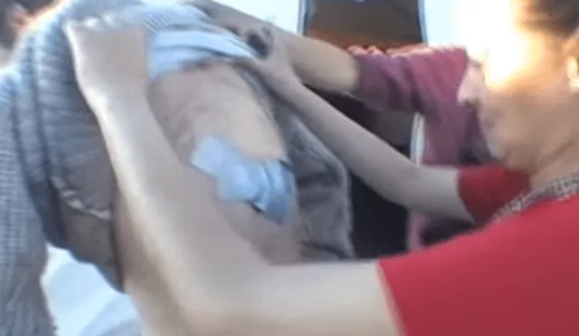 YouTube viral: joven va al médico por roncha en su espalda y le hacen espeluznante hallazgo [VIDEO]