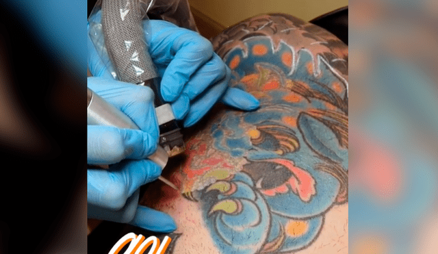Facebook viral: joven intenta quitarse tatuaje del brazo, sin imaginar el terrible resultado que tendría