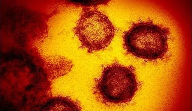 Imagen microscópica del coronavirus causante del COVID-19. Crédito: NIAID (Estados Unidos).