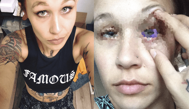 Facebook: modelo que se tatuó el ojo revela la terrible consecuencia de su acción [FOTOS]