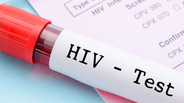 Día Nacional de la Prueba del VIH: Minsa realizará exámenes gratuitos